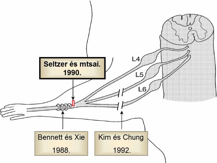 Seltzer 1990-es közleménye a részleges szoros n. ischiadicus lekötésével kiváltott neuropátiás fájdalommodellről fontos mérföldkövet jelentett (Seltzer és mtsai. 1990).