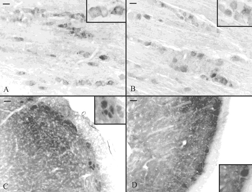 A PAC1 receptor expressziója PACAP +/+ és PACAP -/- egerek trigeminális ganglionjaiban és trigeminális nucleus caudalisában Az immunfluoreszcens reakció alapján mindkét csoport trigeminális