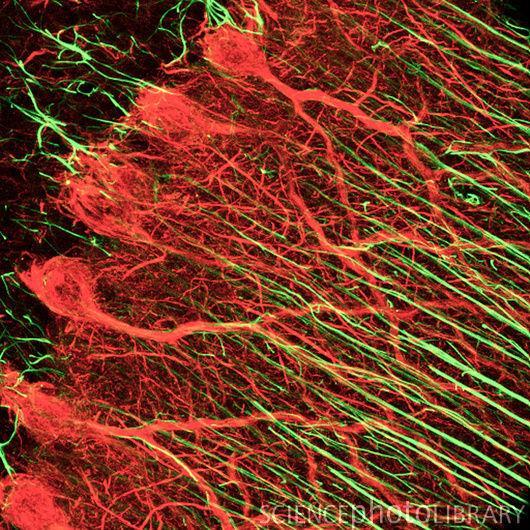 Bergmann glia hgfap-gfp - Golgi-féle epiteliális sejt = Bergmann