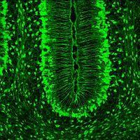 protoplasmic astrocytes) gcl: granule cell layer wm: white matter