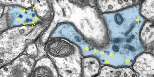 Glycogen granules Sárga nyilak: glikogén szemcsék asztrocitában kicsi, kerek, sötét szemcsék glikogén glükóz Neuronokban is van glikogén szintetáz, de inaktív.