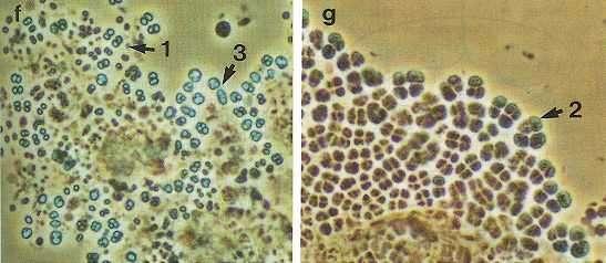 szelektoros rendszerben észleltek (Liu et al., 1994). A következő három csoportba sorolták az előforduló GAOk-at: 1.