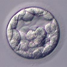 beáramlása Trophoblast (TB): magzatburok külső lemeze (chorion) fetalis placenta Embryoblast: