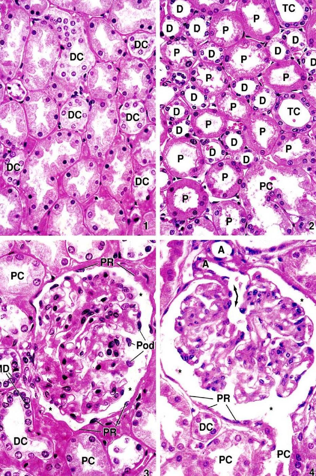 PARS CONVOLUTA LOBULI CORTICALIS (1,3,4) PARS RADIATA LOBULI CORTICALIS (2) DC: distalis kanyarulatos csatorna PC: proximalis