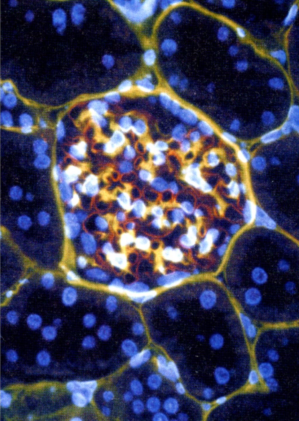 PROTEOGLIKÁNOK A GLOMERULUS MESANGIUMBAN (SÁRGA, PIROS). IMMUNHISZTOKÉMIA. MIA.