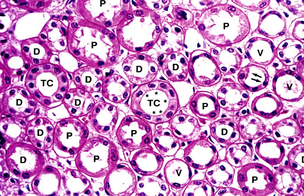 MEDULLA RENALIS: ZONA EXTERNA (TUBULUS