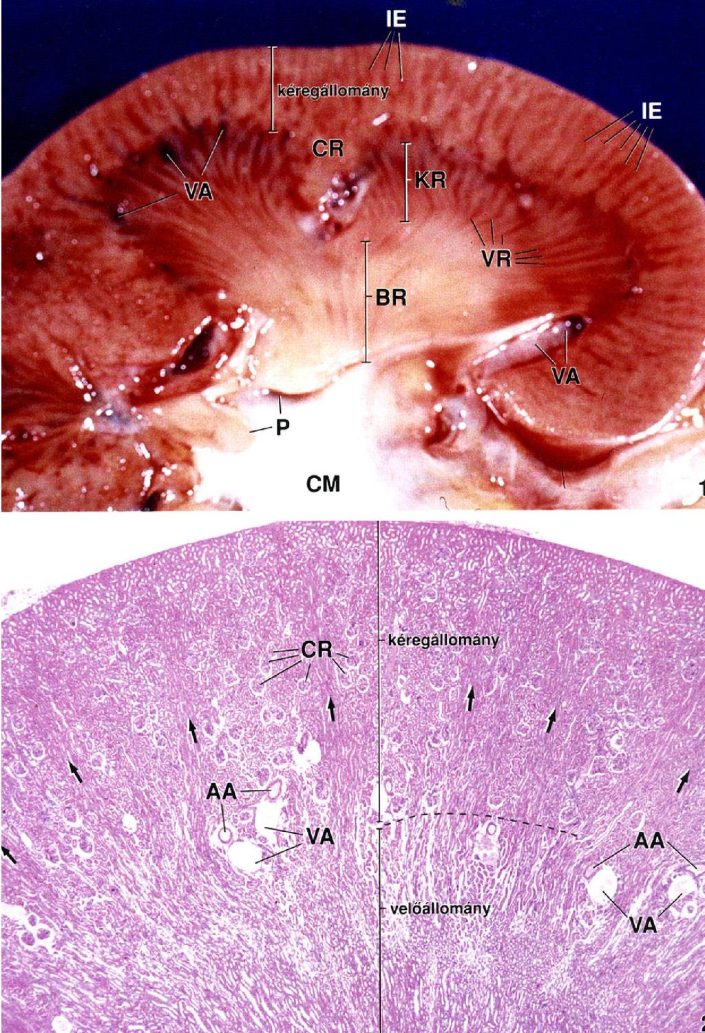 Emberi vese metszete (a vese egyik pólusa), p kéreg- és s velőállom llomány egyaránt látszik. l Egy kiskehely (CM) szintén látható.