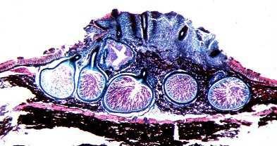 2.1.3. A Cryphonectria parasitica morfológiai jellemzése A kórokozó sztrómája jellemzően szétszórt, lapított gömb alakú (2.