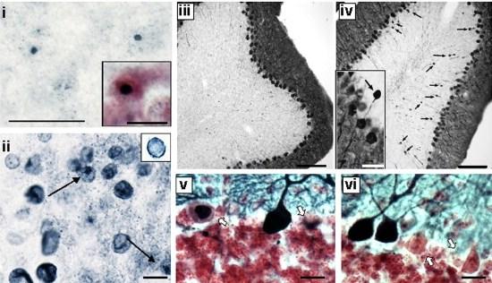 25. Ábra A 120 tripletismétlıdést tartalmazó ~100 hetes premutációs hím egér CNS patológiája Az ábrán az i-vel jelölt rész az ubiquitin immunreaktivitást mutatja a thalamus parafascicularis