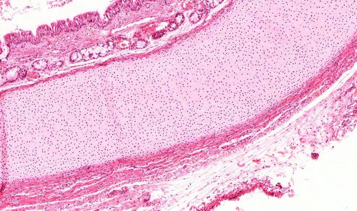 Trachea (HE), 5x epithelium mucosae : egyrétegű többmagsoros csillós