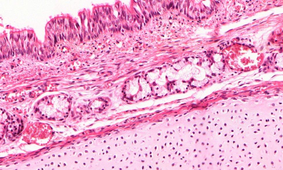 Trachea (HE), 20x egyrétegű többmagsoros csillós hengerhám