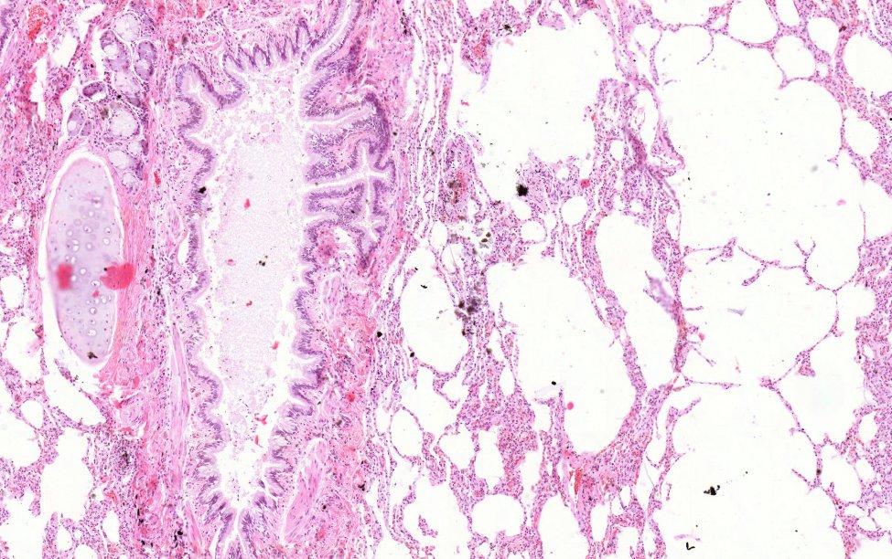 Tüdő (HE), 5x mirigyek epithelium lumen Bronchus: 1. T. mucosa: - többmagsoros csillós hengerhám - a hám fokozatosan alacsonyodik, a l. propria vékonyodik a kisebb bronchusok felé haladva. 2. T. muscularis: - a nagyobb bronchusokban összefüggő réteg, a kisebbekben spirális lefutásúak.