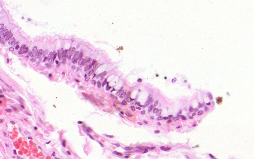 bronchiolus lumene