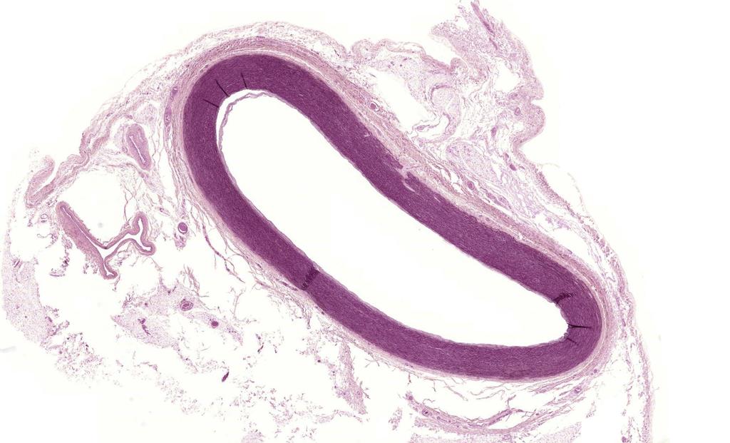 Aorta (resorcin-fuchsin), 1x - Elasztikus típusú artéria Tunica intima: endothel, lamina basalis str.