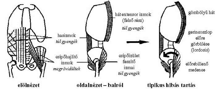 Medenceöv