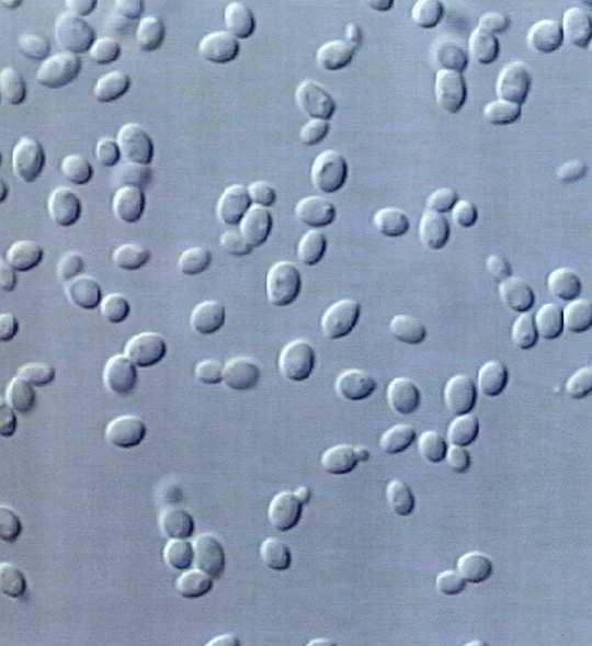 5-5 µm; gömb, pálca vagy spirális, osztódással szaporodnak, egyesek spóraképzők Sugárgombák: