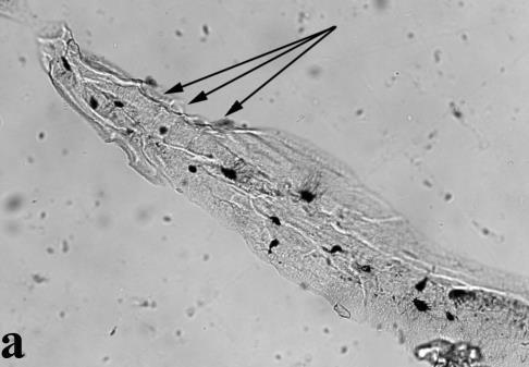 3. ábra: Nigrovits József (29. számú múmia), csigolyatest. Vékony-réteg csiszolat (70 µm); a b: transzmissziós, c: polarizációs mikroszkópos felvétel. 200x nagyítás.