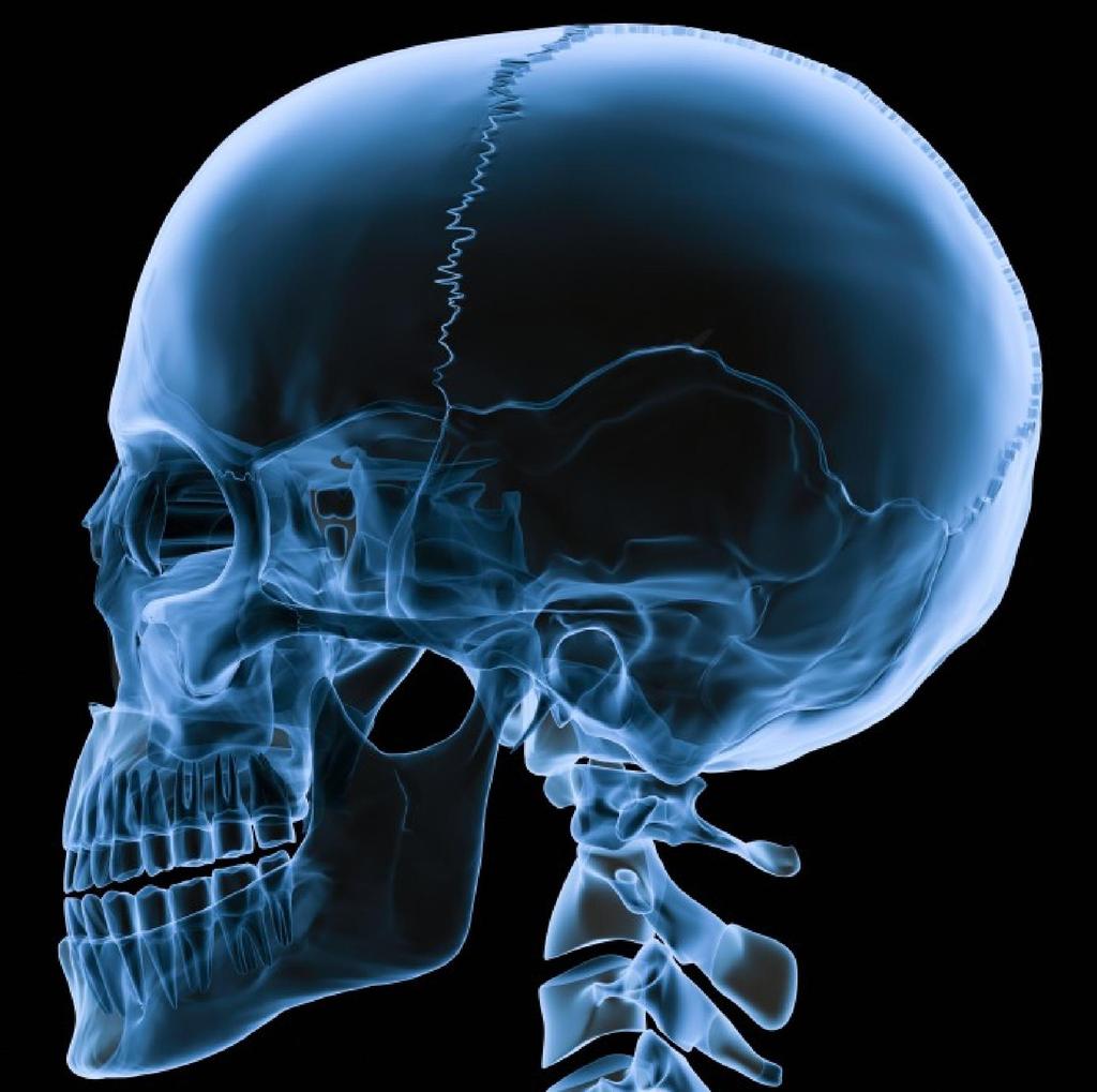 Agykoponya - neurocranium Koponyatető calvaria Koponyaalap basis cranii Arckoponya -