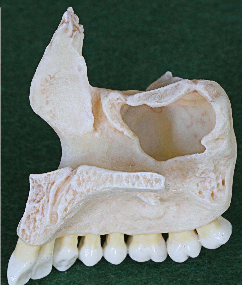 Alveolaris Arcus alveolaris Alveoli dentales Septa interalveolaria Septa