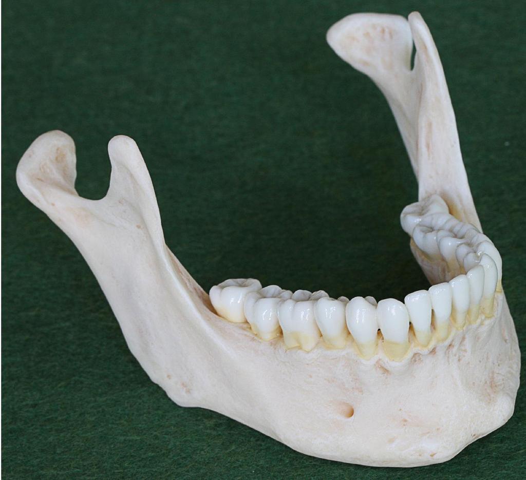 Mandibula Corpus mandibulae Rami mandibulae Angulus mandibulae