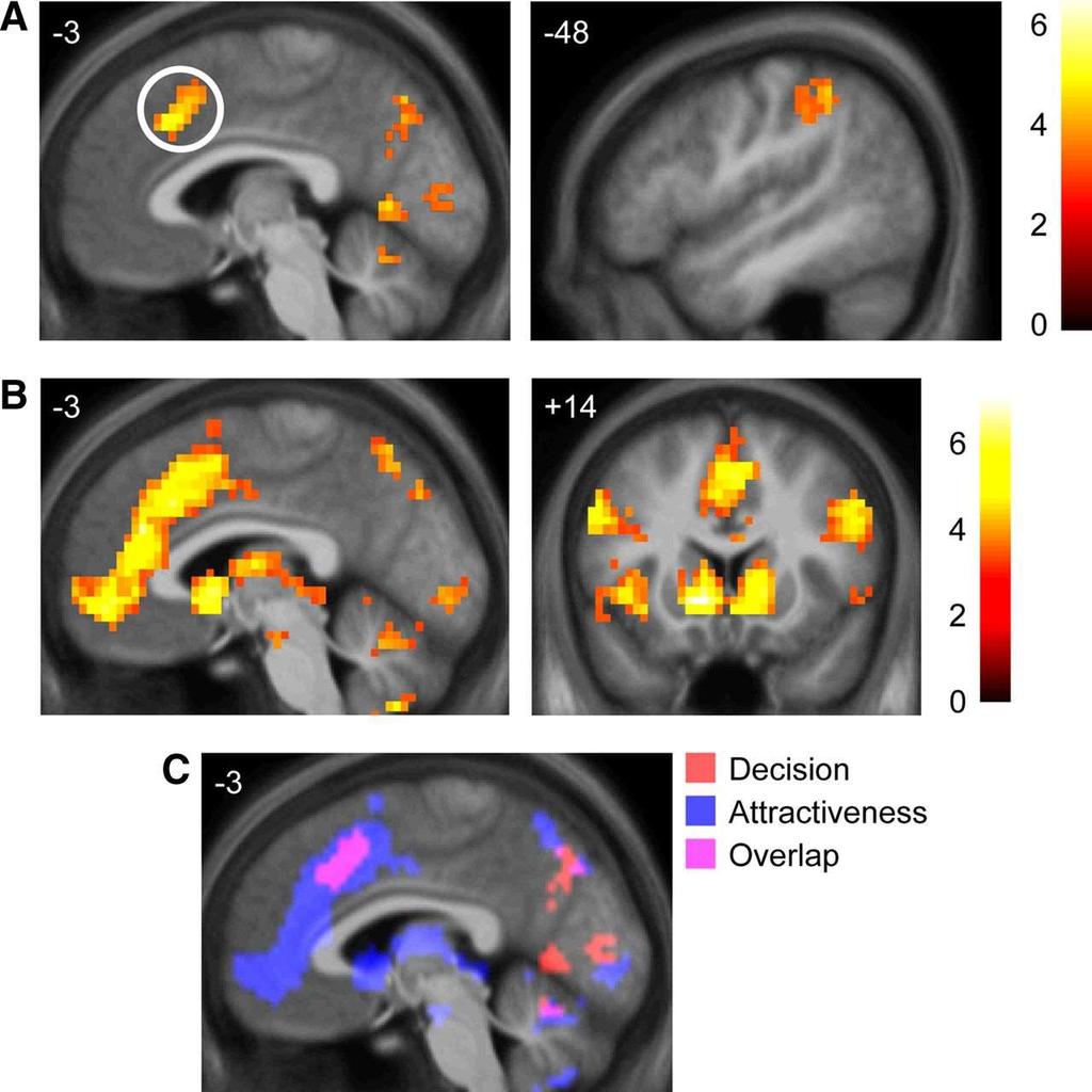 Neural predictors of subsequent decision compared with areas mediating judgments of physical attractiveness.