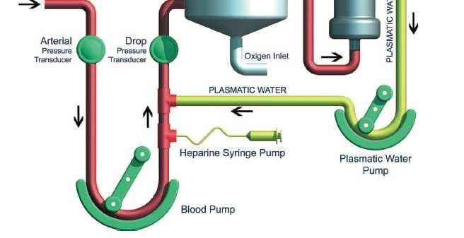 25) (n=22) - módosított vv hemofiltrációs rendszer - közbeiktatott 0.