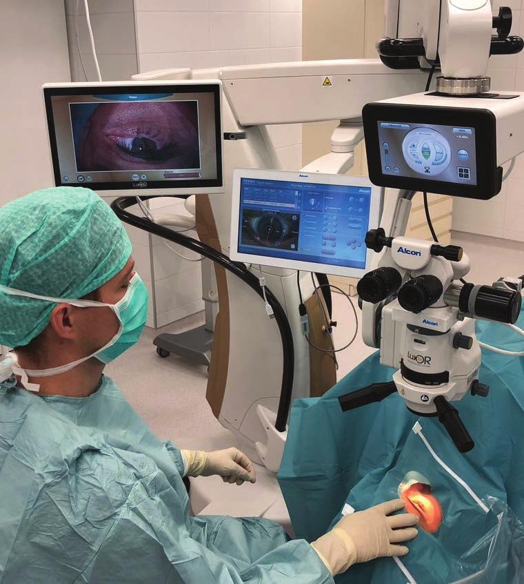 Lézeres látásjavító kezelésnél Kétlézeres kezelésnél a Femtoszekundum lézer használatához a szemét egy csatlakozóval (dokkolóval) megérintjük.