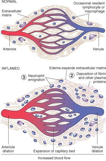 VASCULAR REACTIONS Hyperemia Aktív folyamat fokozott arteriolás beáramlás