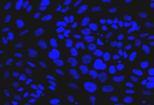 Transzcitózis CACO-2 ÉS IN VIVO TRANSZPORT EPITÉLSEJT Sejttenyészetek a biofarmáciában