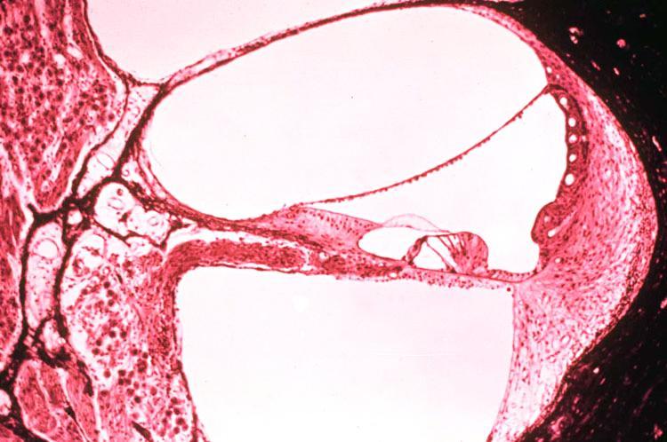 Scala media stria vascularis membrana vestibularis (Reissner) scala