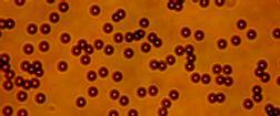 Csak 30-50 µm hosszú, típusos morfológiával