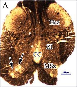 2. ábra. Ozmimummal kezelt Vibratóm metszetek a CM cranialis (A), középsı (B) és caudalis részébıl (C). A szürkeállomány részei: hátsó szarv (Hsz), zona intermedia (ZI) és mellsı szarv (Msz).