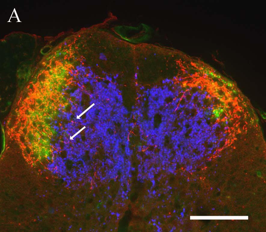 8. ábra. Vibratóm metszetek a CM cranialis (A), középsı (B) és caudalis szakaszáról (C), hármas immunjelölés.