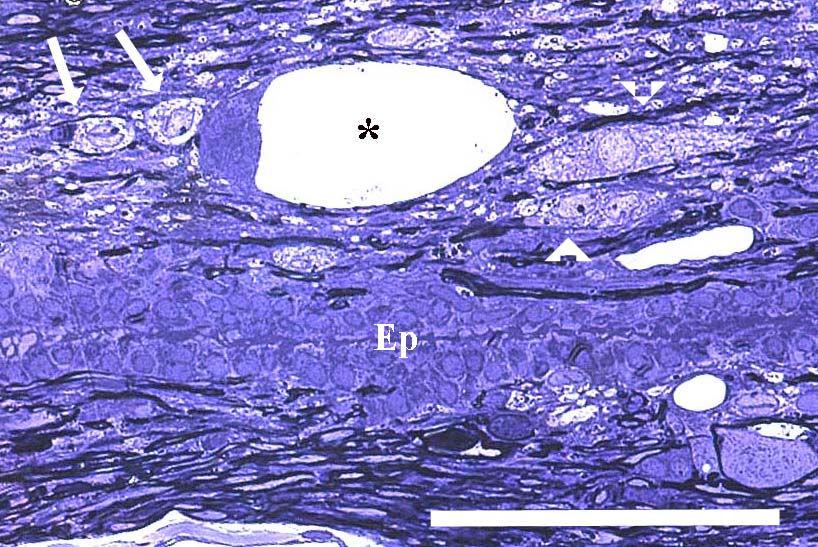13. ábra. FT nagy nagyítá-sú hosszmetszeti képe, fél-vékony metszet, toluidin-kék festés. A canalis cent-ralist az összefekvı epen-dyma sejtek (Ep) jelölik.
