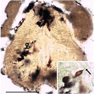 A fehérállományban a myelinhüvelyes idegrostok (az ábra alsó részében) hosszmetszetben találhatók. Tág lumenő eret * jelzi.