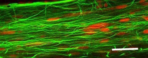 perikaryonok is (16. ábra). A neuronok gyakran kisebb csoportokban helyezkednek el. Ezeket a csoportokat három, négy vagy öt sejt alkotja, gyakran a canalis centralis közvetlen szomszédságában (15.