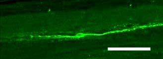 17. ábra. NK-1r pozitív neuron a FT hosszmetszeti képén. A neuron dendritjei a FT hosszában húzódnak.