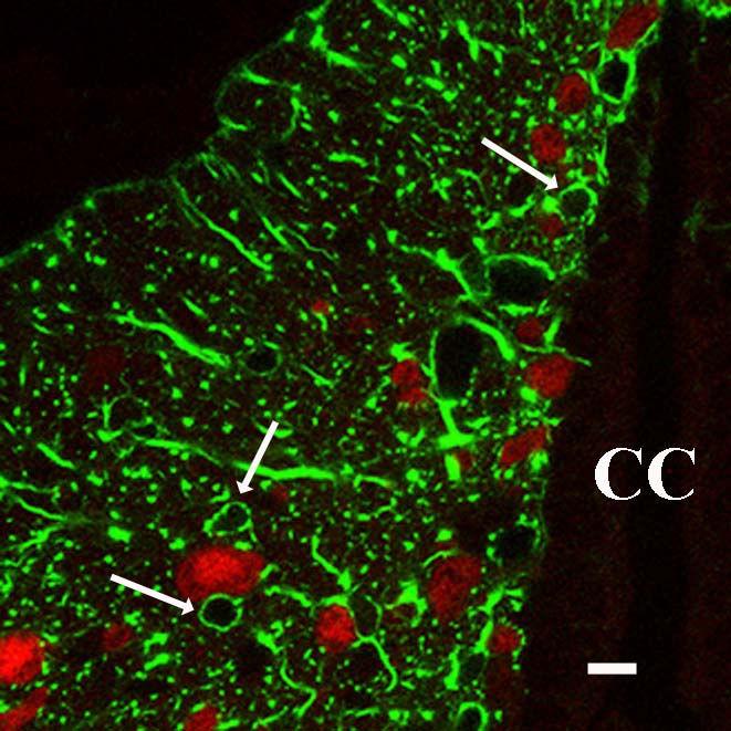 18. ábra. Kettıs immunjelölés a FT keresztmetszeti képén. A neuronok sejtmagját NeuN ellenanyaggal jelöltük (piros), a GFAP jelölés (zöld) az astrocyta nyúlványokat tünteti fel.