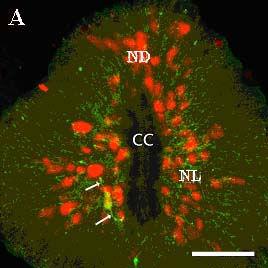 20. ábra Hármas immunjelölés a FT keresztmetszeti képén. LN = nucleus lateralis, DL = nucleus dorsalis, CC = canalis centralis.