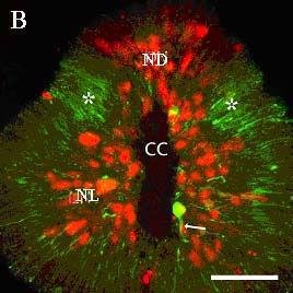 B: NeuN (piros) és, calretinin (zöld) immunpozitív neuronok, a nyíl a calretinin-pozitív neuron dendritjére mutat.