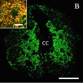 B: Szinaptofizin-pozitív axonvégzıdések (zöld) ugyancsak a nucleus lateralisban halmozódnak.