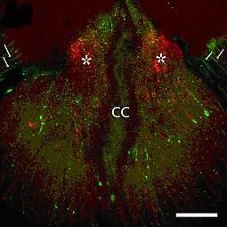 Dús szinaptofizin jelölt varikozitások (piros) figyelhetık meg a nucleus lateralisban (NL). CC = canalis centralis. Mérték: 50 µm 27. ábra.