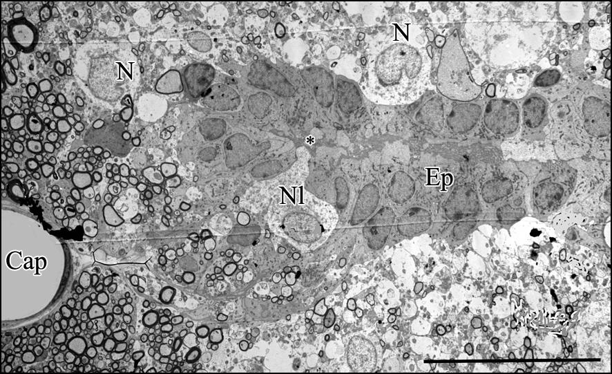 32. ábra. Patkány FT ultrastruktúrája. A canalis centralist szegélyezı ependyma (Ep) sejtek között a lumen csak kis foltban látható (*).
