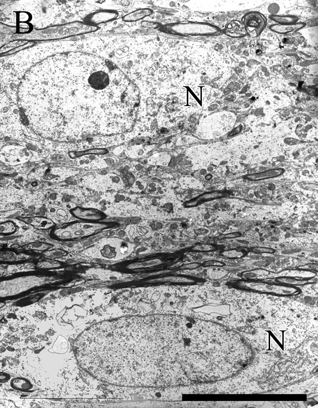 Keresztmetszeti képen a neuronok perikaryonjai (N) kör alakúak. Gl = astrocyták. Cap = kapillárisok. Mérték: 10 µm 33B ábra.
