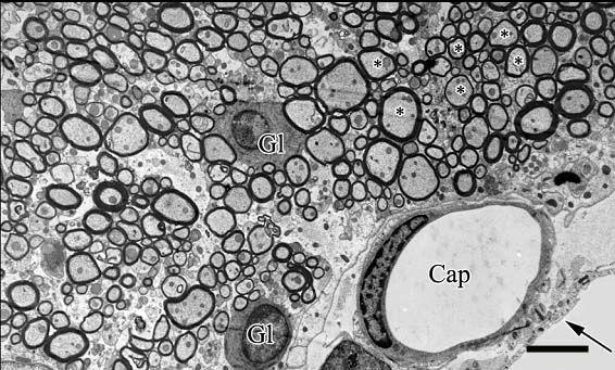 látható. Mérték: 0,5 µm 39. ábra. Patkány FT ultrastruktúrája.