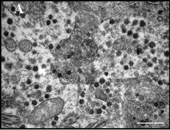 Mérték: 2 µm 42. ábra. Patkány FT ultrastruktúrája. A: a 41. ábrán bemutatott axonvégzıdések nagyított képe.