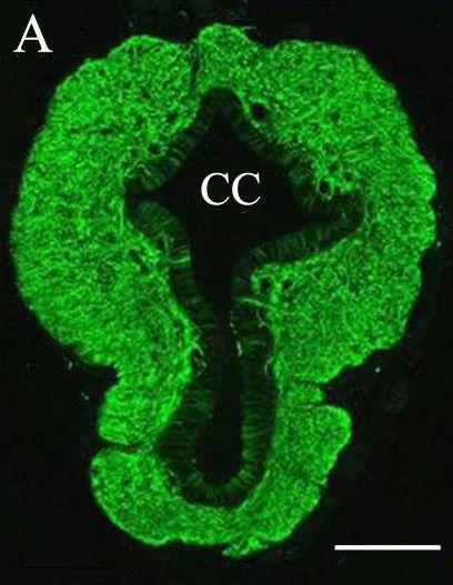 Immunhisztokémiai módszerrel is (NeuN jelölés) láthatóvá tudtuk tenni a neuronokat, amelyek elıszeretettel helyezkedtek el az ependyma sejtek közelében.