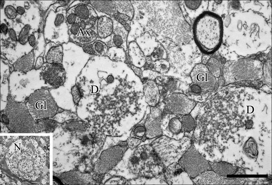 Néhány myelinhüvelyes idegrost körül számos, nagyon vékony myelinhvely nélküli idegrost (*) tölti ki a képet. Mérték: 1 µm 47. ábra. Macska FT ultrastruktúrája.