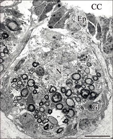 Mérték: 0,5 µm A szövetgömbökben találunk idegsejt perikaryonokat, gliasejteket, és számos myelinhüvelyes idegrostot (51. ábra)