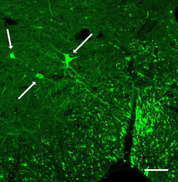 BDA-val jelzett neuronok (nyilak) és axonnyaláb.
